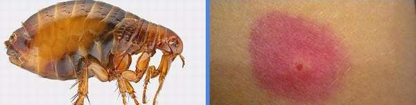 Сыпь после комариных укусов у детей