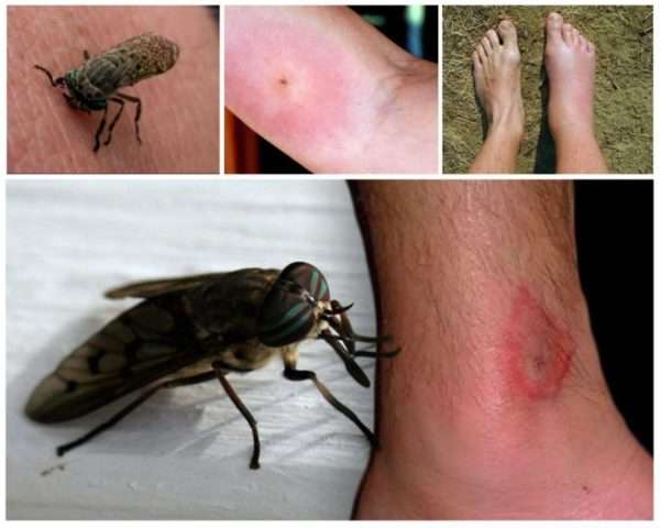 Почему от укуса насекомого появляется отек