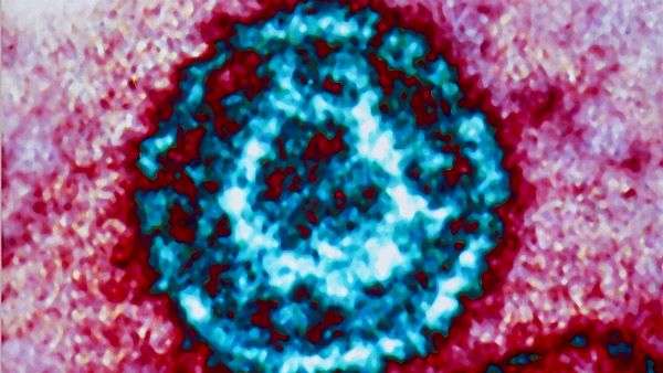 Что означает анализ крови антитела к вирусу эпштейн барр
