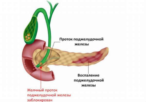 Аюрведа при болезни поджелудочной железы thumbnail