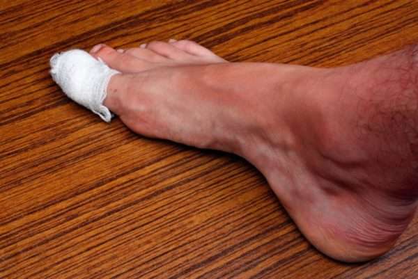 Как вылечить палец на ноге от панариция