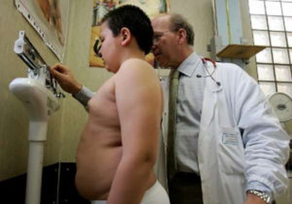 Гипертрофический фимоз часто связан с наличием лишнего веса у ребенка
