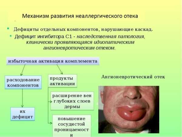 Ангионевротический отек губ лечение