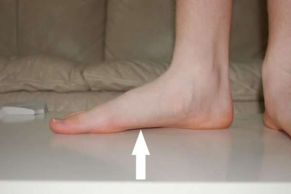 Как вылечить онихомикоз на большом пальце ноги