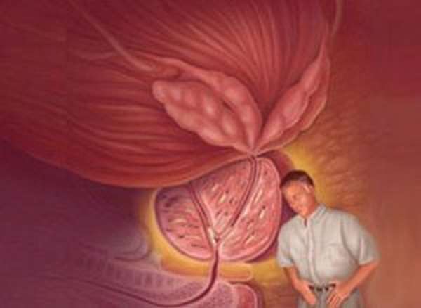 Воспаление семенного мужчин. Что такое везикулит предстательной железы. Трихомонадный везикулит. Катаральный везикулит. Везикулит — воспаление семенных пузырьков.